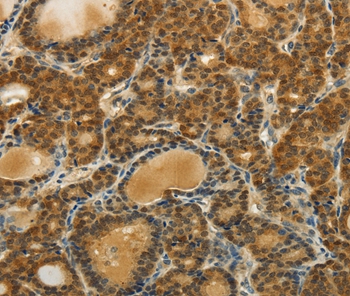 SOCS5 Antibody