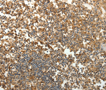 SFTPD Antibody