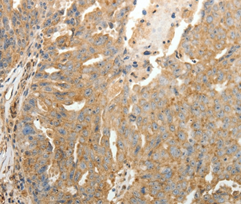 SFTPD Antibody