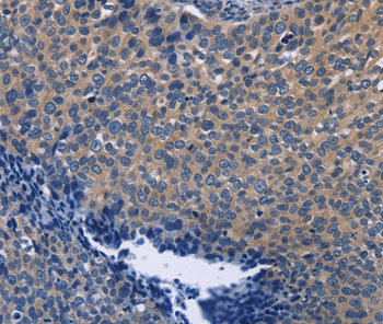 SYT17 Antibody