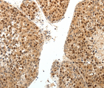 SPATA2L Antibody