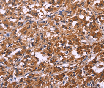 SPATA7 Antibody