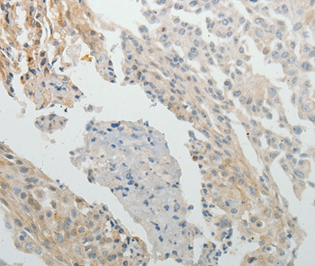 SPATA17 Antibody