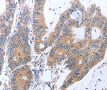 TAT Antibody