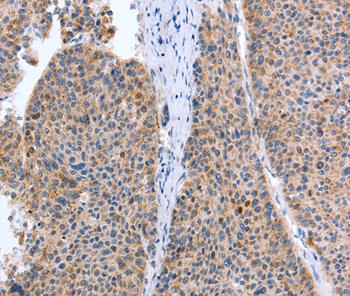 TAT Antibody