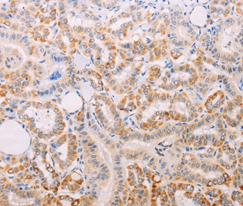 MAP3K12 Antibody