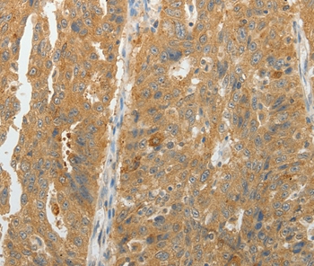 MAP4K5 Antibody