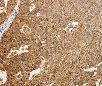 TFF2 Antibody