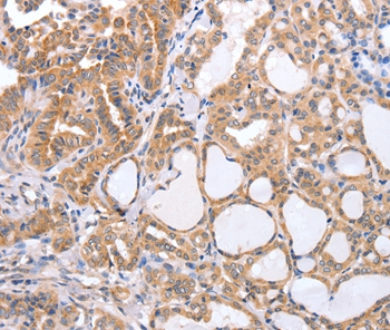 TGFA Antibody