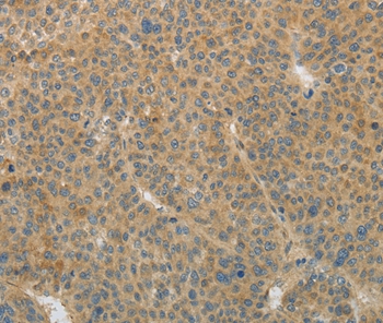 TGFB1 Antibody