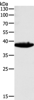 TGFB1 Antibody