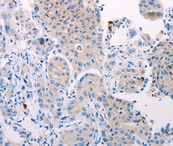 TEKT4 Antibody