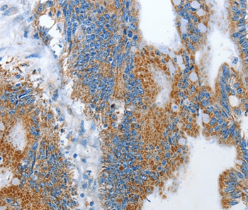 RARRES3 Antibody