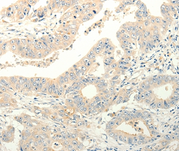 TPH1 Antibody