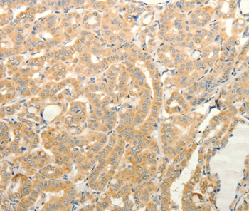 TPH1 Antibody