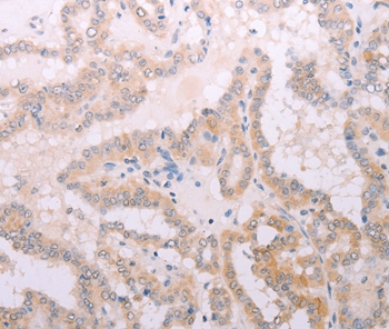 TPO Antibody