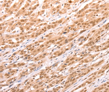 TAX1BP1 Antibody