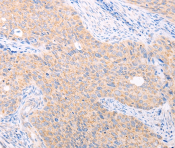 TRIM32 Antibody