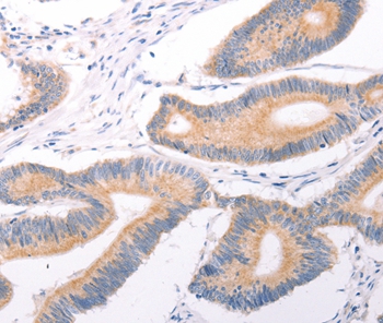 TRPC7 Antibody