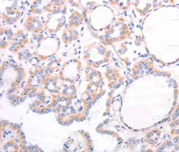 TRPC7 Antibody
