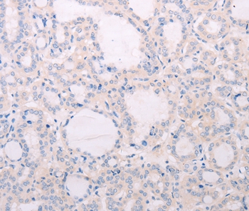 TSHR Antibody