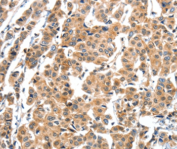 XBP1 Antibody