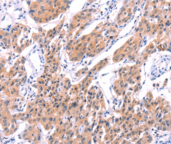 STXBP2 Antibody
