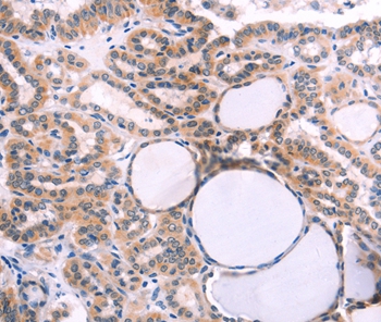 IL1RL1 Antibody