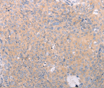 ABCF3 Antibody