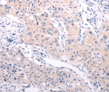 ABCF3 Antibody