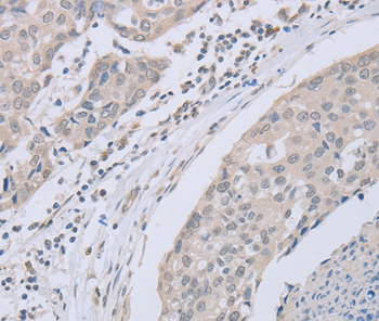 ABLIM1 Antibody