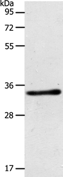 ACY3 Antibody
