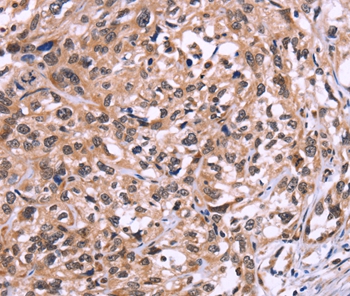 AMIGO2 Antibody