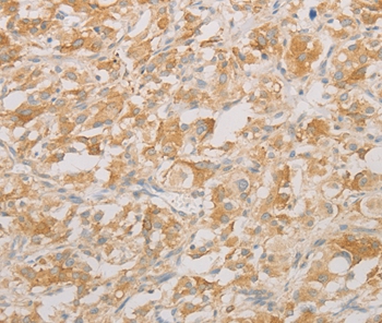 AES Antibody