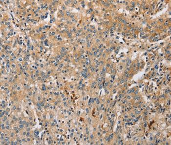 ARL8A Antibody