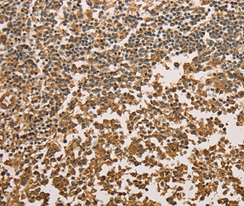 SETD2 Antibody