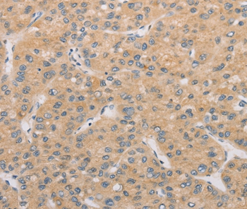 ATG4D Antibody