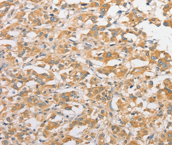 TLR5 Antibody