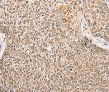 RPL26L1 Antibody