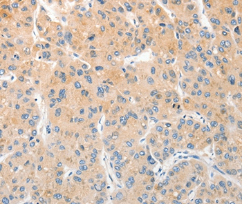 RPN1 Antibody