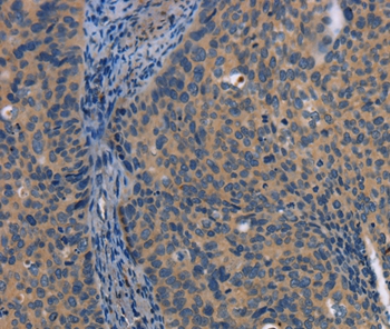 LATS1 Antibody