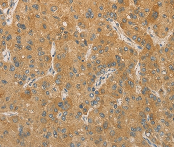 PRPSAP1 Antibody