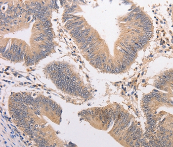 PIP5K1A Antibody