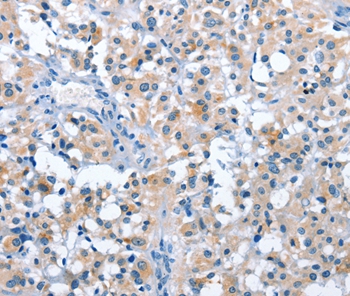 ASB2 Antibody