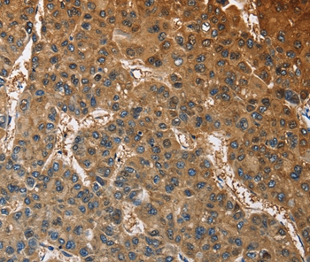 ATP1B2 Antibody