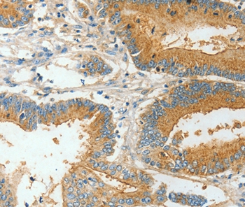 BAAT Antibody