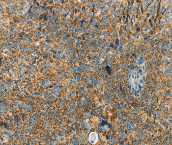 BCAT2 Antibody