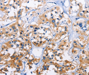 CAPZA3 Antibody