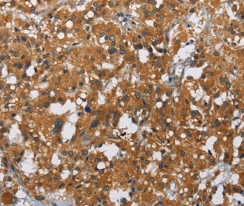 CARD9 Antibody