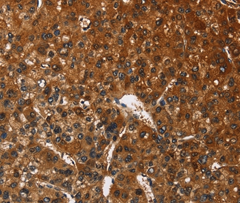 CATSPER4 Antibody